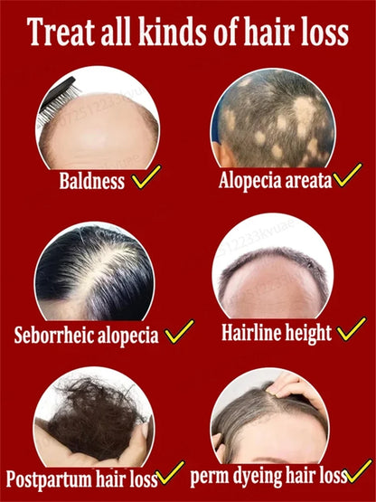 98% of customers repurchase, have more and more hair, say goodbye to baldness