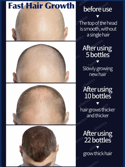 98% of customers repurchase, have more and more hair, say goodbye to baldness